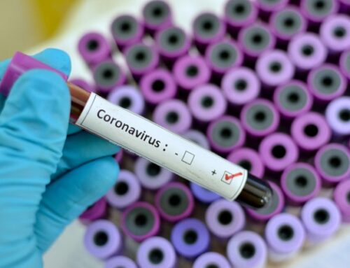 Impact of Coronavirus on Agro Industries